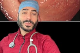 Doktor pokazao kako izgleda BOLESNO DEBELO CREVO: Ovaj snimak je videlo 4 miliona ljudi i garantujemo da se ŽELUDAC SVIMA OKRENUO