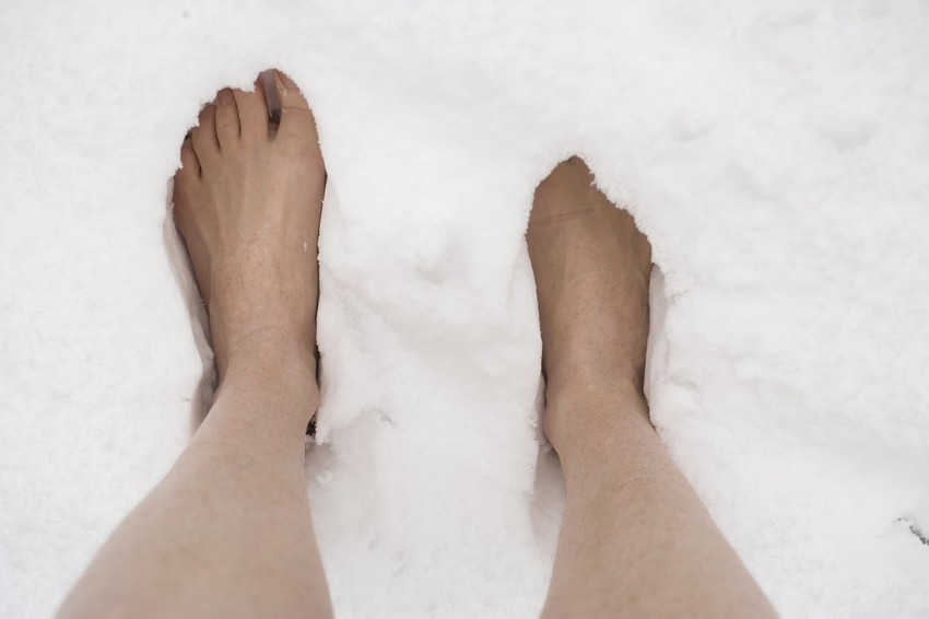 Izlaganje izvorima toplote može još više da pogorša promrzlinu