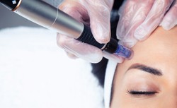 Mezoterapia igłowa - skuteczny zabieg dla każdego