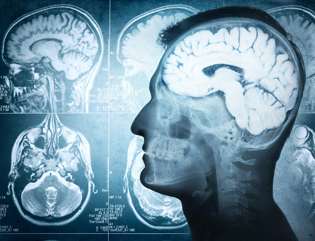 Zmniejsza się wraz z wiekiem, nie odczuwa bólu. 10 fascynujących faktów na temat mózgu!