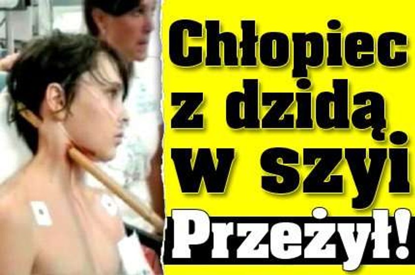 Chłopiec z dzidą w szyi. Przeżył!