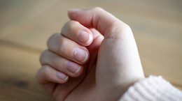 Łuszczyca paznokci – przyczyny, objawy, leczenie