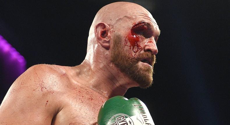 Tyson Fury cut