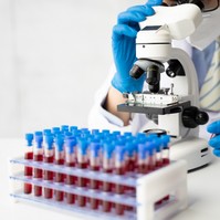 Kóros trombocitaszám - súlyos hematológiai betegségeket is jelezhet