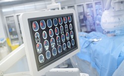 Dlaczego niektóre operacje na otwartym mózgu przeprowadzane są w ciemności?