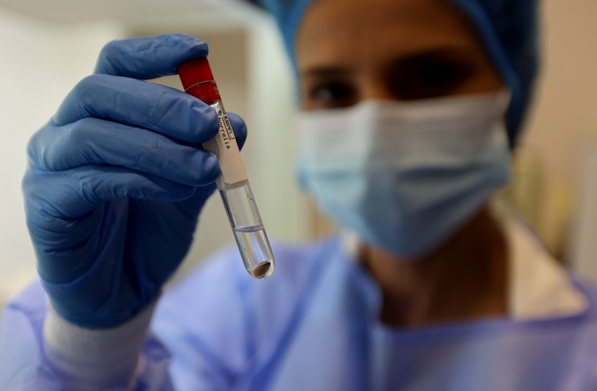 Testiranje krpelja u Zavodu za javno zdravlje Beograd 