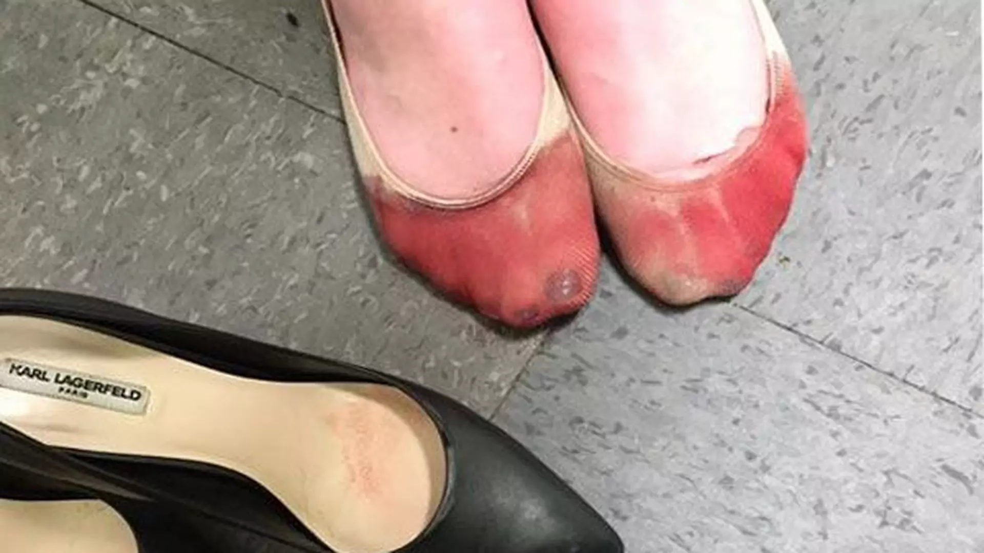Kelnerka publikuje zdjęcie zakrwawionych stóp, by zdemaskować seksitowski regulamin w pracy