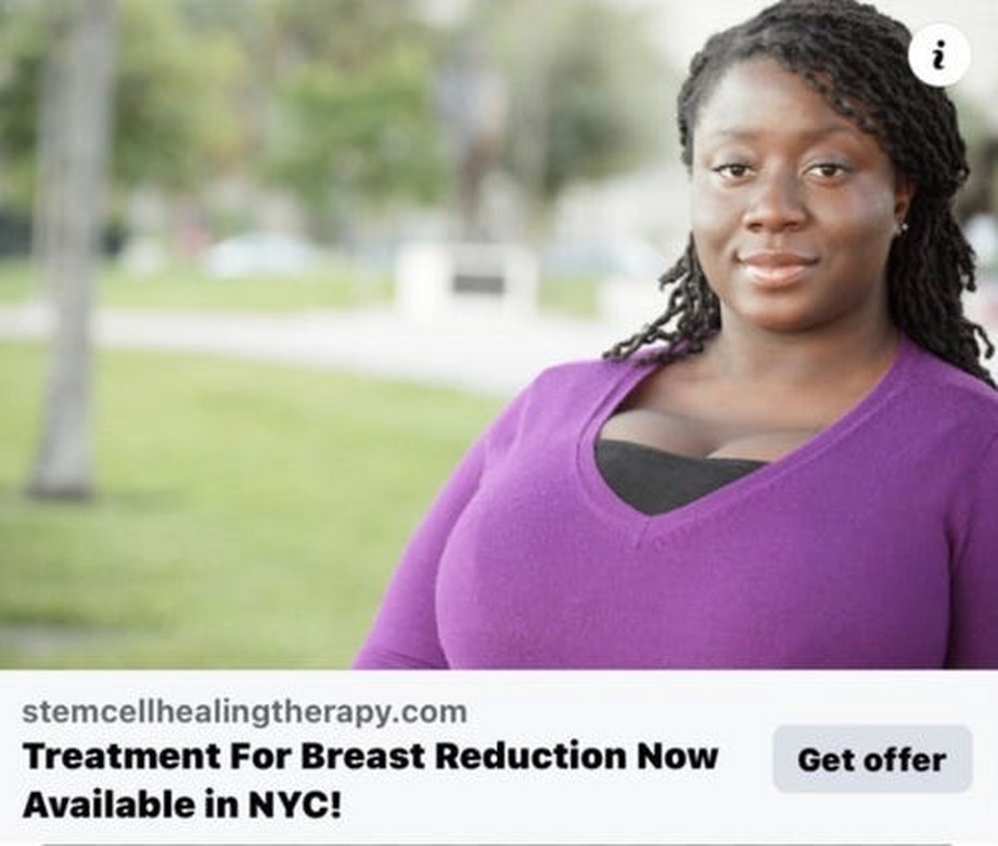 Zdjecie zostało wykorzystane w reklamie dotyczącej redukcji piersi.
