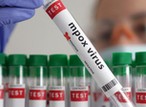 Tension rises as Mpox outbreak surges, remains uncontrolled in Africa