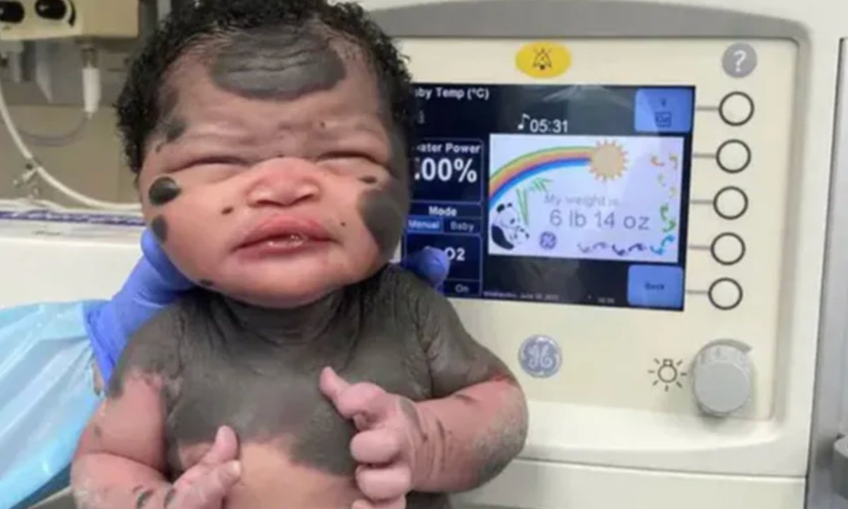 Cztery lata temu poznał ją cały świat. Tak dziś wygląda słynna "dziewczynka panda"