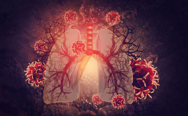 Płuca zainfekowane wirusami i bakteriami