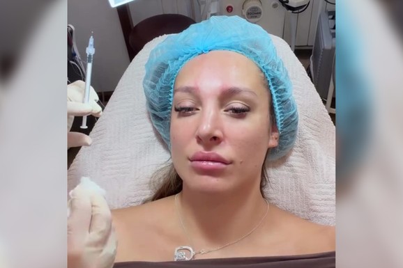 LUNA ĐOGANI NAPUNILA 30 GODINA PA OTIŠLA NA BOTOKS Otkrila da uklanja bore poznatim tretmanom, ovako podmlađuje lice