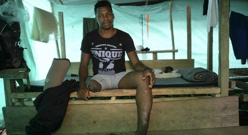 Blown through the air after stepping on a landmine, FARC guerrilla fighter Jair, says life was hard when you've never been taught how to live after losing a leg