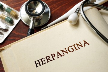 Herpangina: a betegség főleg óvodáskorban jelentkezik, hurutos tünetekkel jár, és magától gyógyul. 