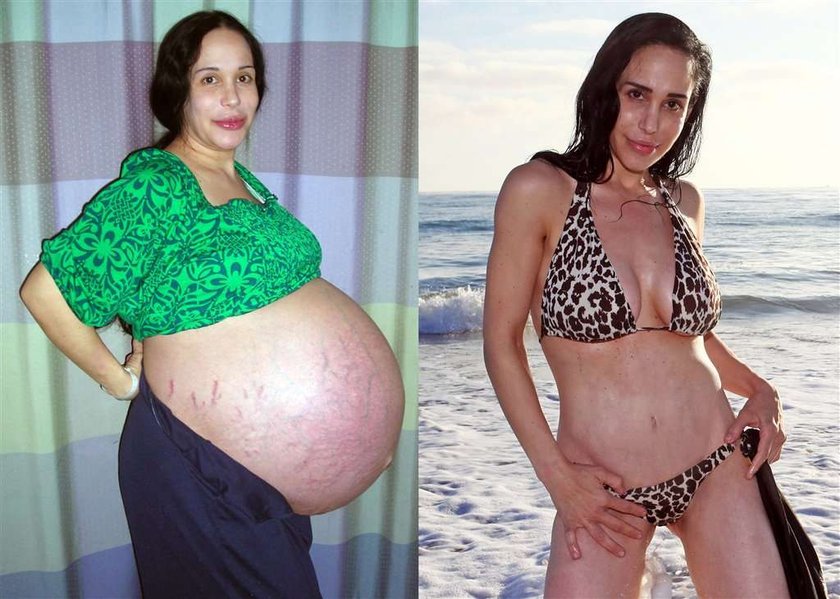 Nadya Suleman schudła 50kg