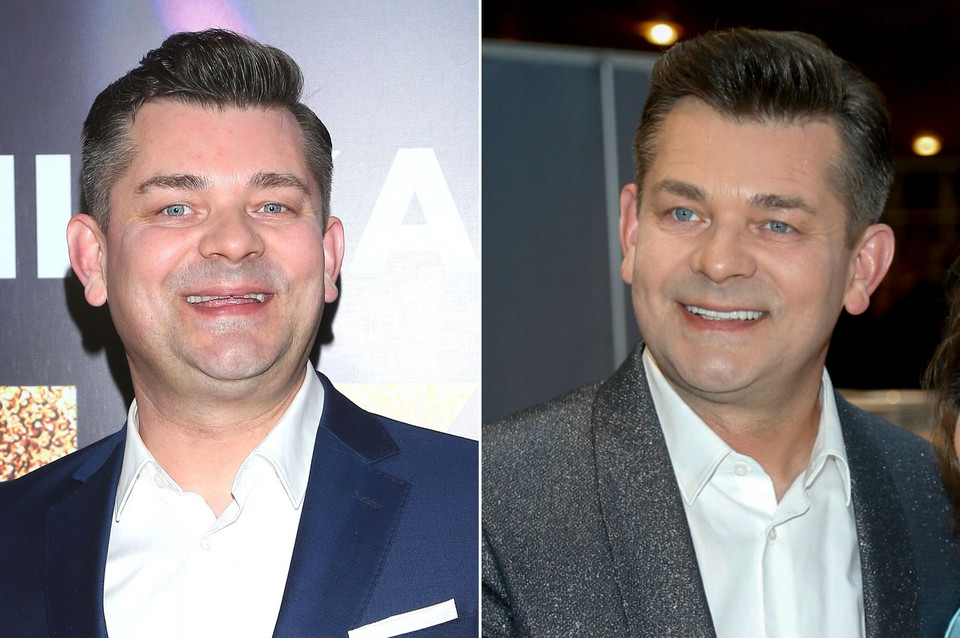 Zenek Martyniuk przed i po poprawieniu uśmiechu