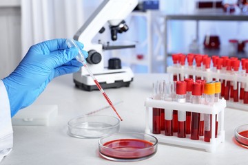 Hogyan készül, és milyen betegségeket mutat ki egy vérkép?