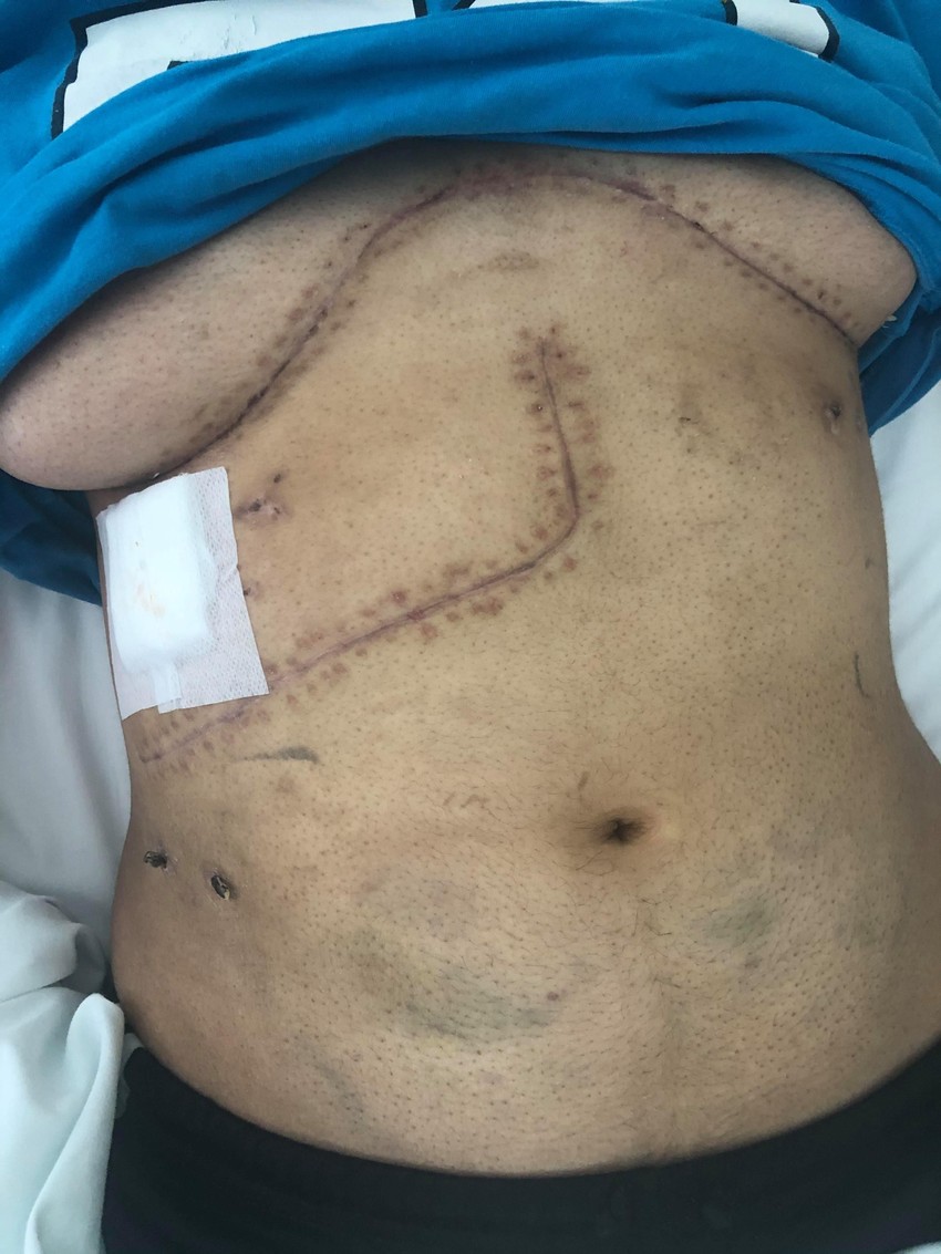 Majrina pluća su bila skroz uništena usled dejstvovanja virusa COVID-19 na njen organizam