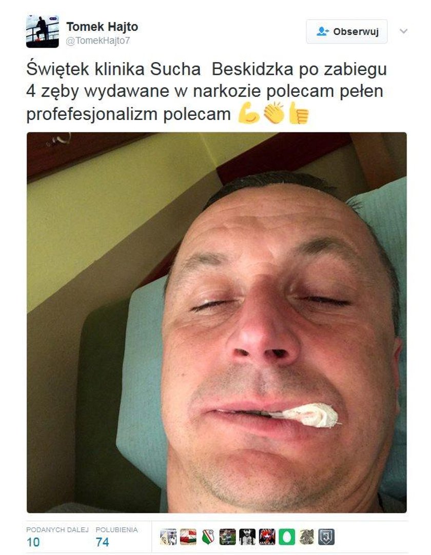 Były reprezentant Polski pochwalił się zabiegiem