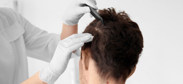 Dlaczego warto badać skórę głowy?