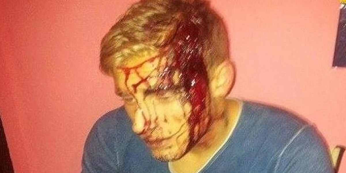Angielski piłkarz Connor Wilton zaatakowany siekierą