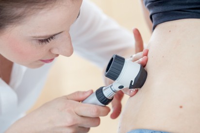 Az alapos anyajegyszűrés legfontosabb ismérvei