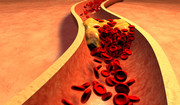 Mity na temat cholesterolu – komu zagraża, leczenie statynami, dieta [WYJAŚNIAMY]