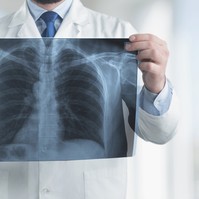 Ezek a hörgőgyulladás fájdalmas tünetei: a köhögés csak az egyik jel