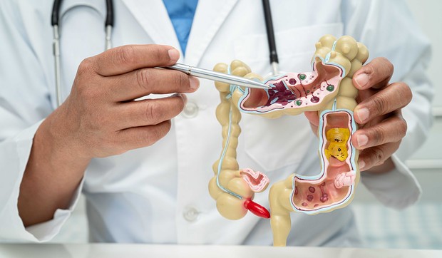 Kada se poremeti ravnoteža mikrobioma, najpre počinju da se javljaju stomačne tegobe 