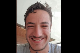 Mladić (24) otišao u Tursku na TRANSPLANTACIJU BRADE, pa posle tri meseca IZVRŠIO SAMOUBISTVO: "Napravili su mu ježeve bodlje na licu, nije mogao da spava od BOLOVA"