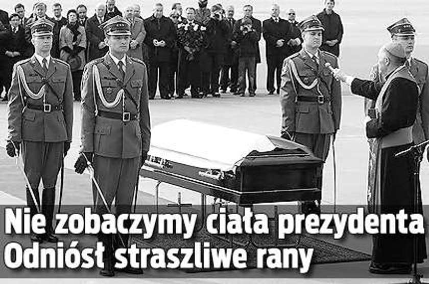 Nie zobaczymy prezydenta. Odniósł straszliwe rany