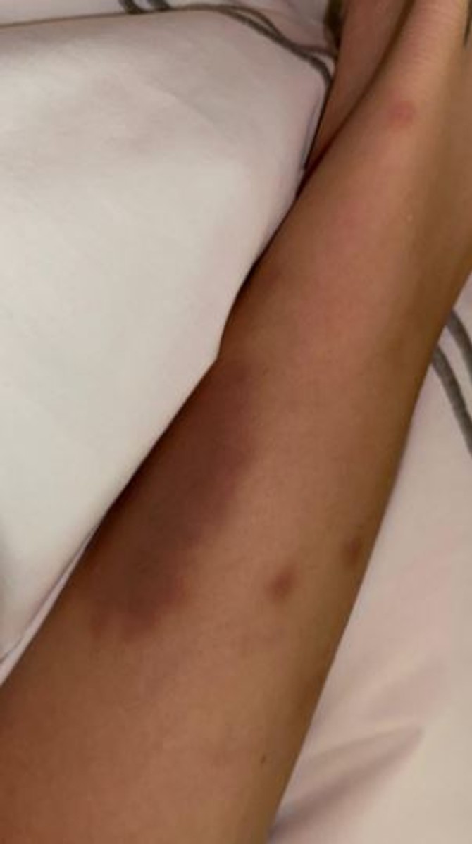 Objava Bele Hadid na Instagram storiju