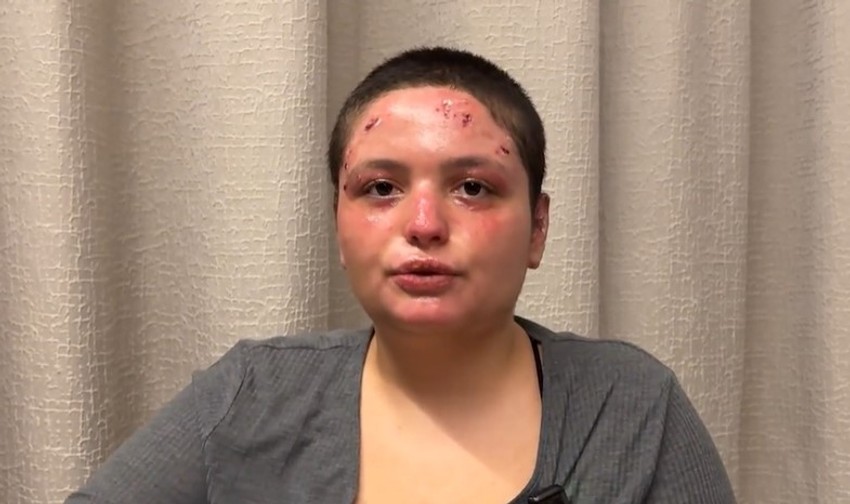 Žrtva požara u Kran-Montani