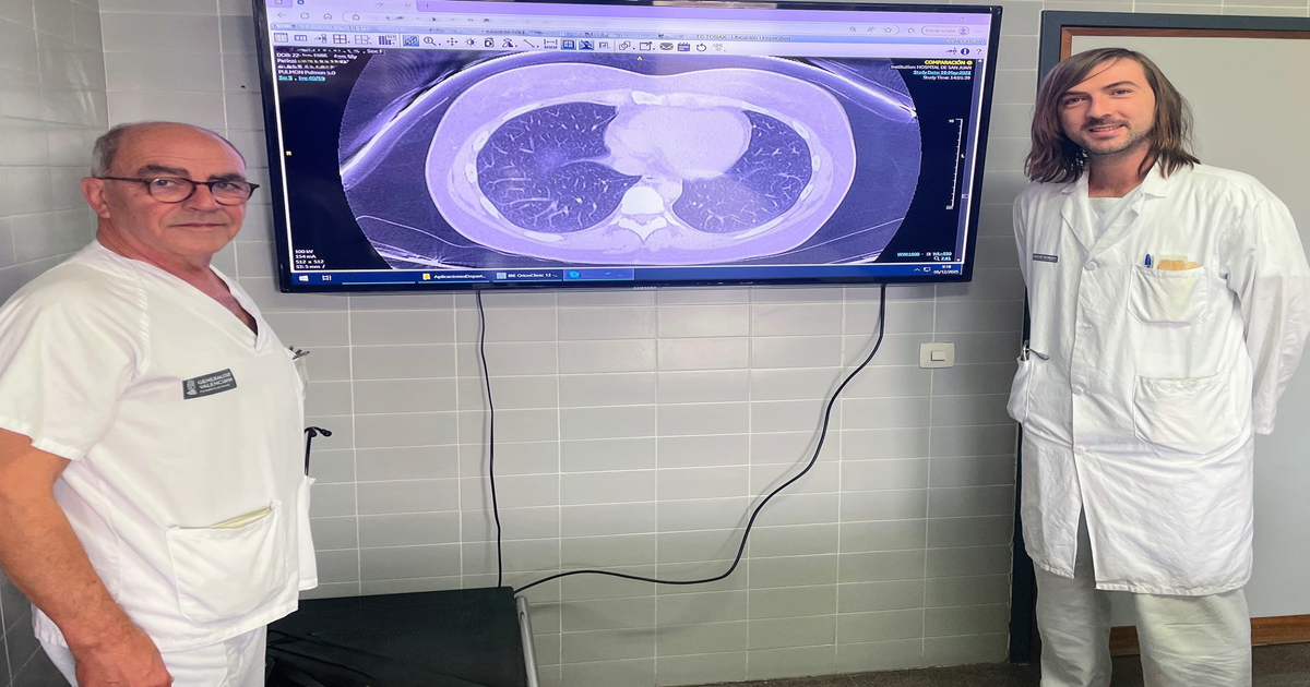 Asma grave: IA de Alicante evita daños irreversibles con predicción personalizada