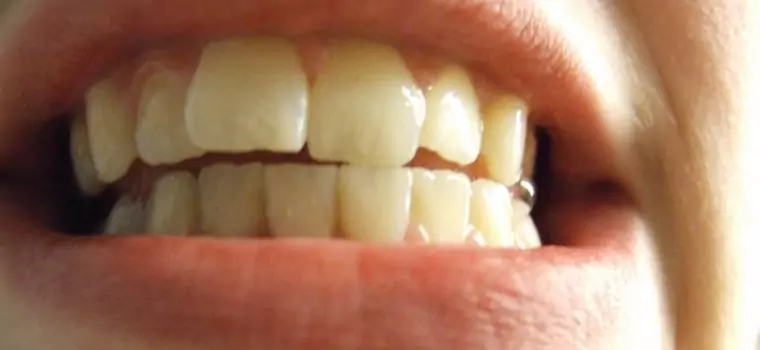 Naukowcy obdarzą nas bioimplantami zębów