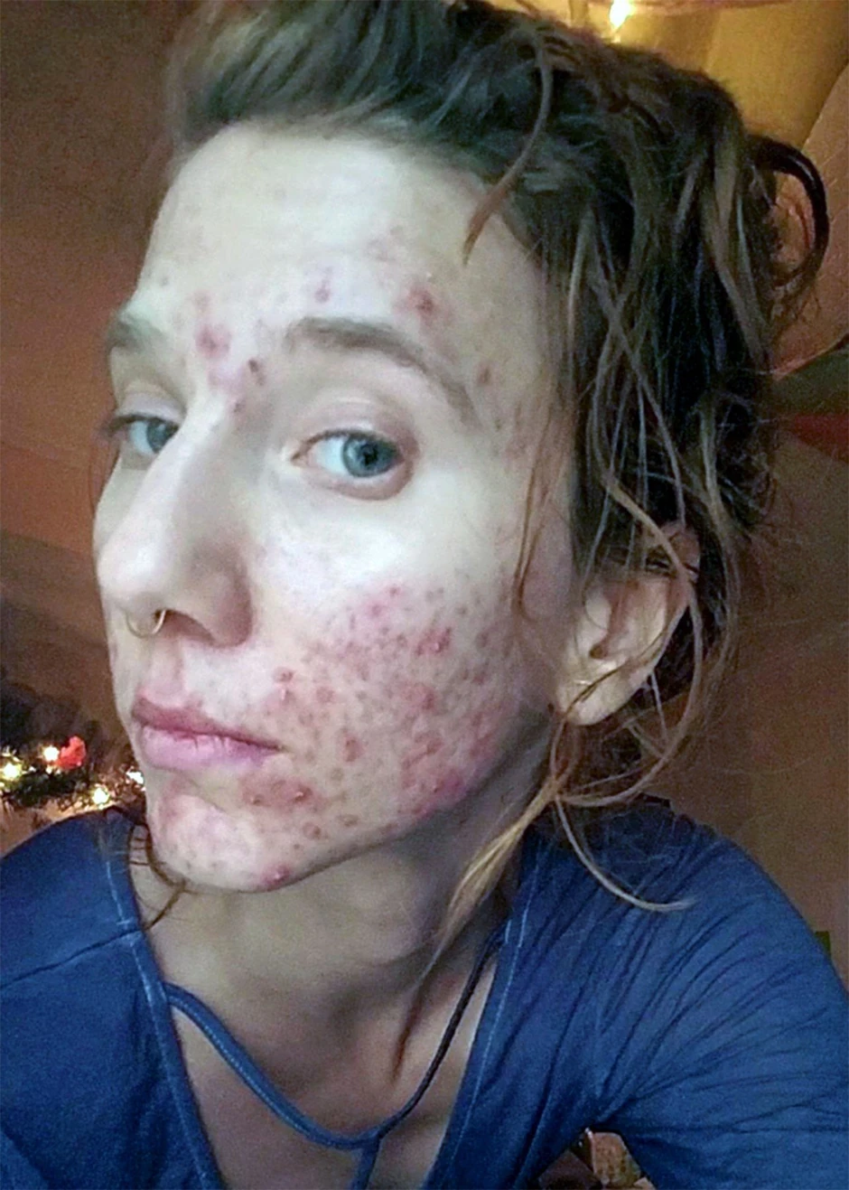 Džulija pre nego što je počela da koristi mokraću