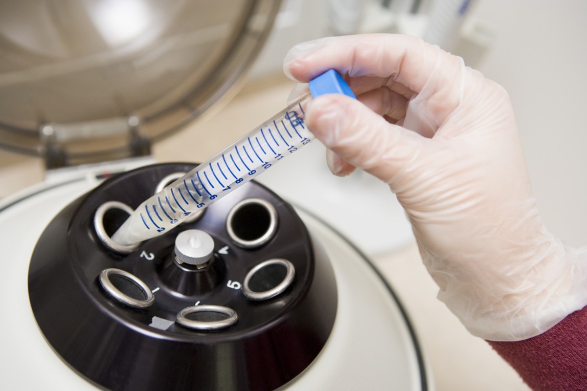 In vitro. Co wiemy o nowelizacji ustawy? Pytania i odpowiedzi