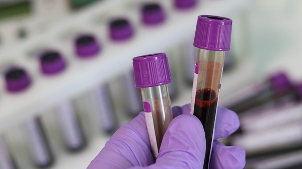 W Poznaniu brakuje krwi