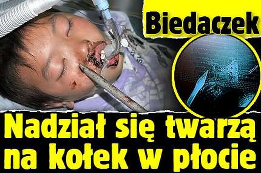 Biedaczek. Nadział się twarzą na kołek w płocie