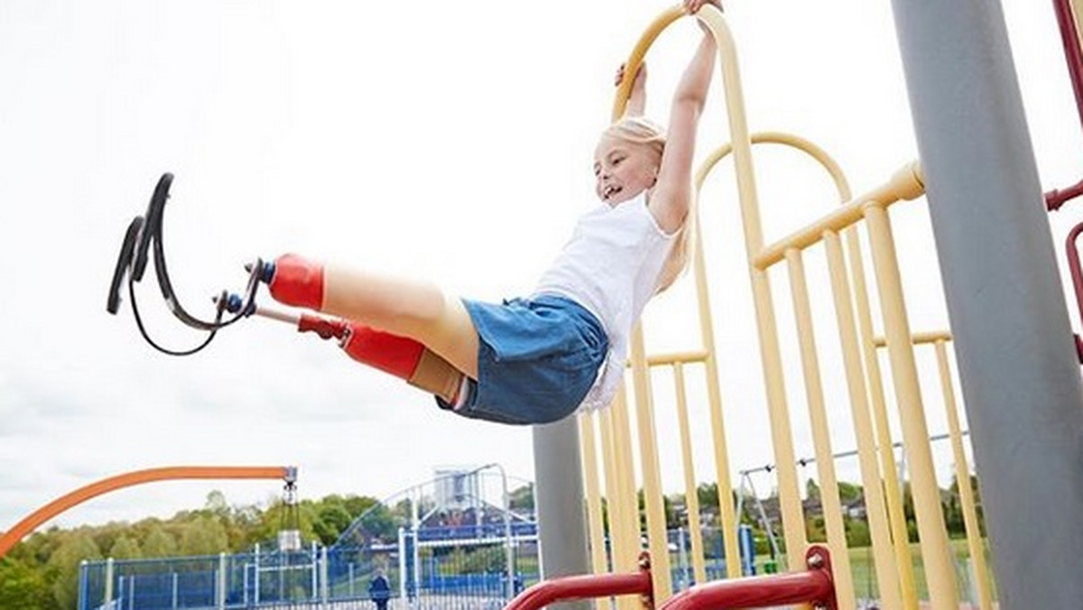 Siedmioletnia Daisy-May Demetre ma obie nogi amputowane. Zaraz po urodzeniu u dziewczynki zdiagnozowano hemimelię strzałkową. To rzadka wada wrodzona, charakteryzującą się brakiem całej kości strzałkowej lub brakiem jej części, jednocześnie występuje nierówność kończyn, deformacja kolana i stopy.