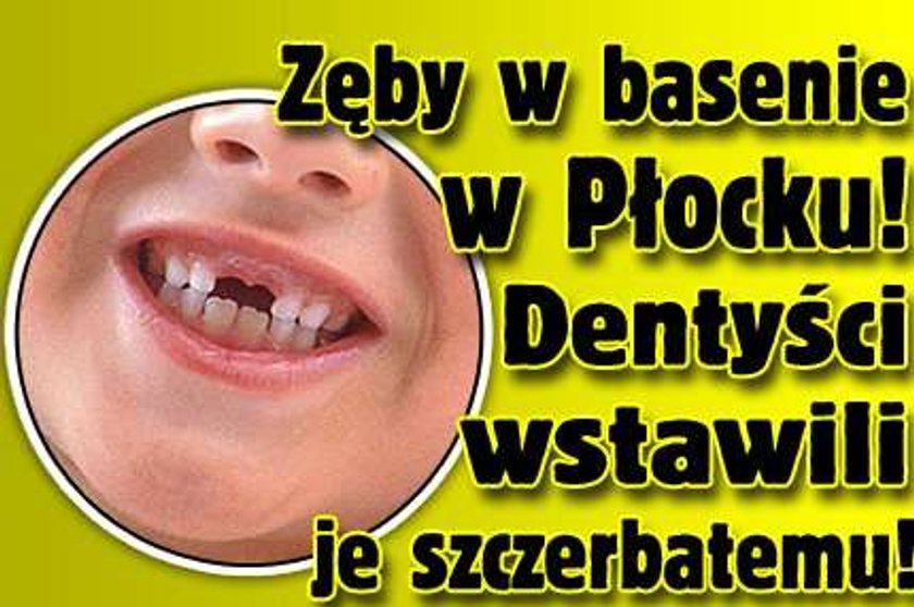 Włoch stracił zęby na basenie w Płocku! Wstawili mu je