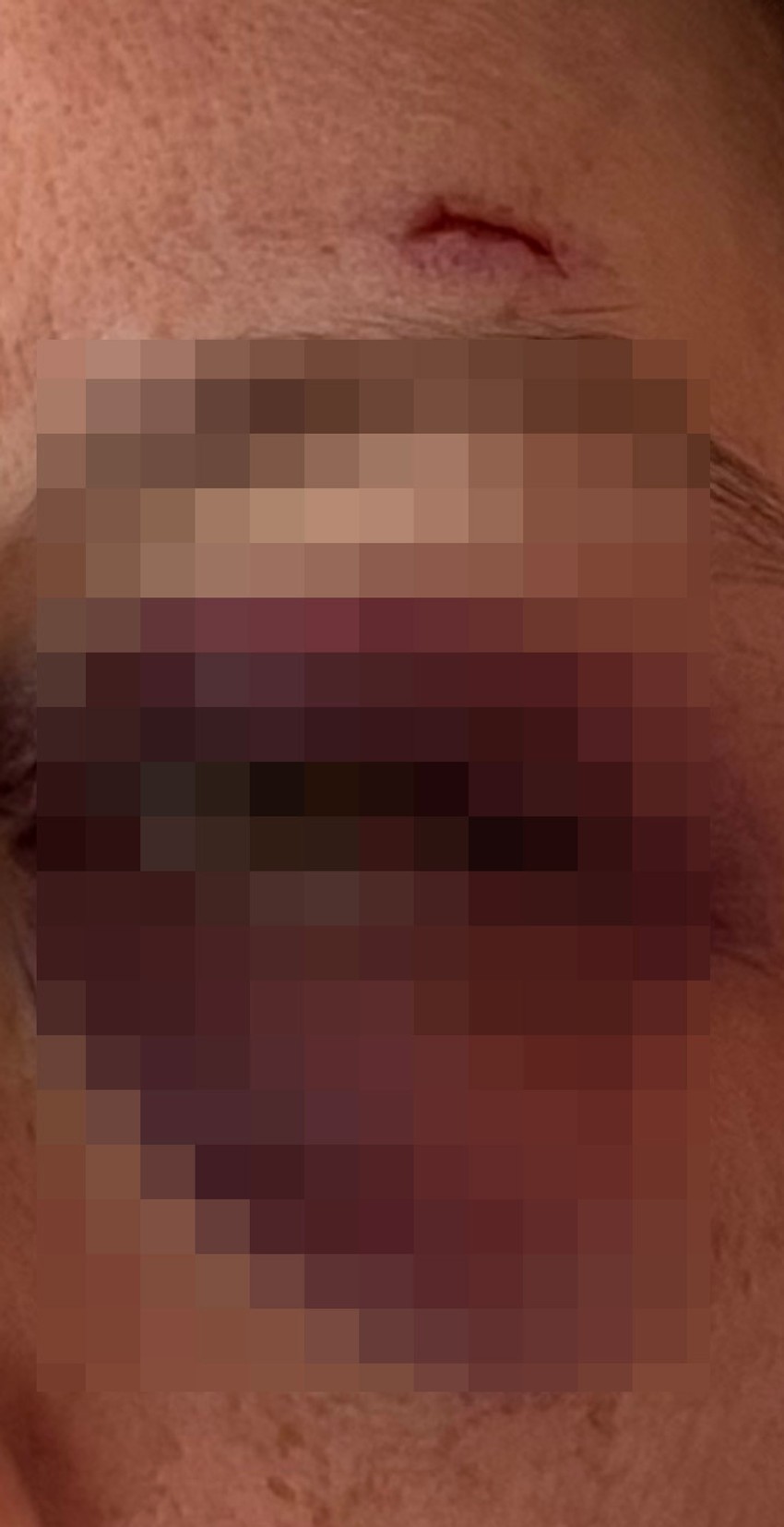 Žena koju je muž prebio i pucao u nju