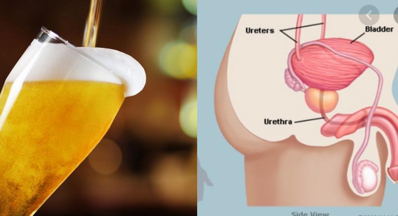 Man's bladder bursts after drinking 10 beers but refusing to urinate for 18 hours