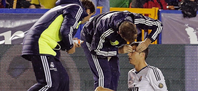 Cristiano Ronaldo nie pomoże Portugalii. Ma rozbity łuk brwiowy