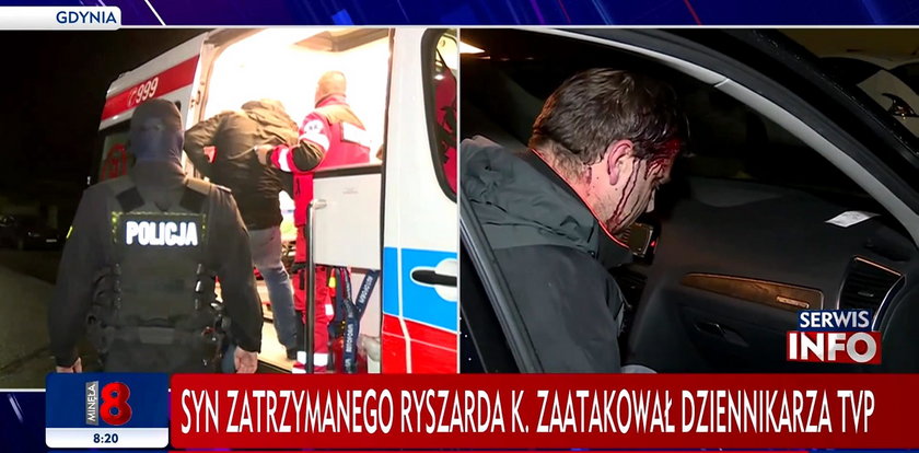 Syn znanego biznesmena nie odpowie za pobicie reportera TVP. Poseł PiS pisze pismo do ministra Ziobry