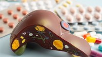 Zsírmáj: visszafordíthatja-e egy egyszerű vitamin a világ leggyakoribb májbetegségét? című cikk nyitóképe