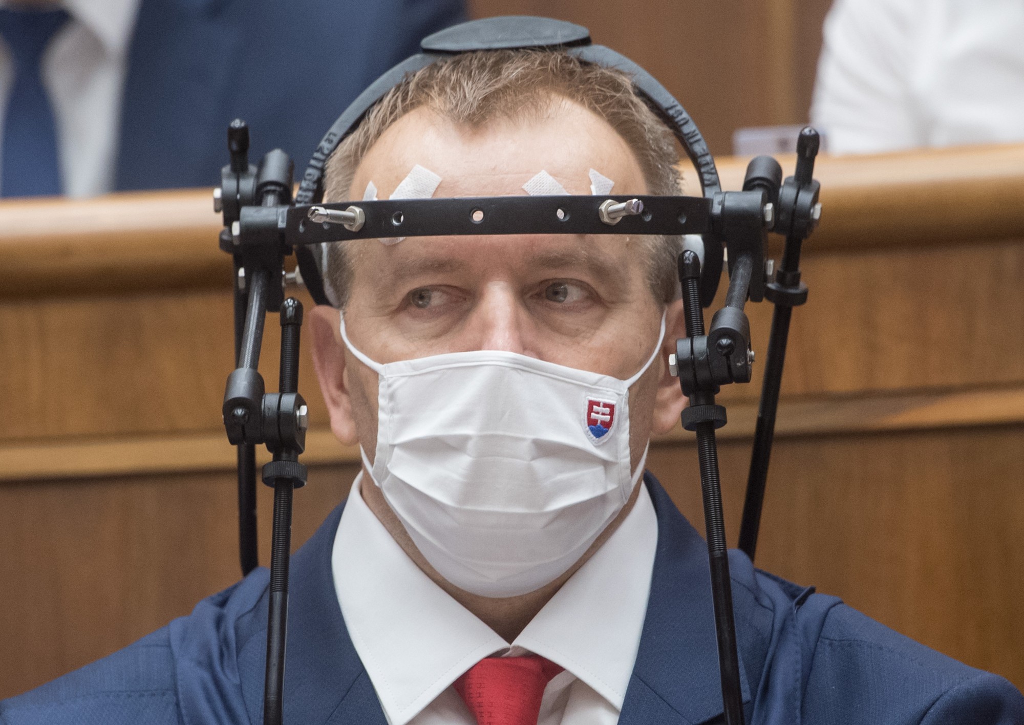 Boris Kollár po nehode na jeseň 2020.