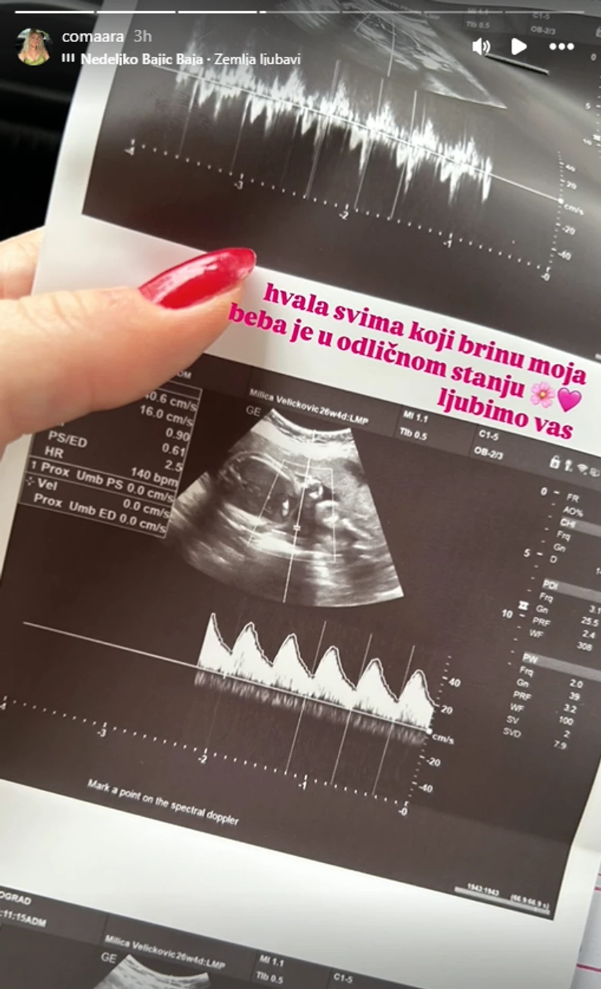 Milica Veličković (Foto: Instagram)