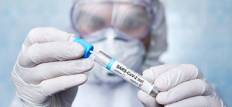 Epidemia koronawirusa. Poświąteczny spadek zakażeń, ale duży wzrost zajętych łóżek. NOWE DANE