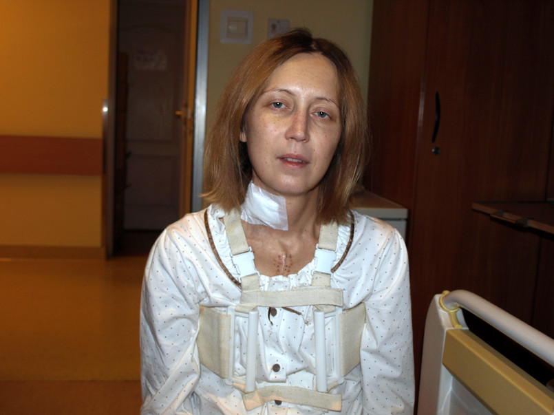 Adriana Szklarz w szpitalu po przeszczepie serca
